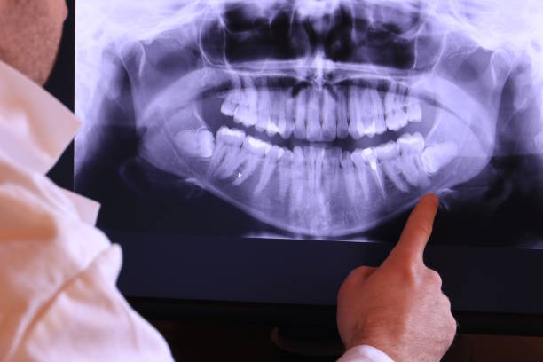 Best Broken or Cracked Tooth Emergency Dentist in Waskom, TX