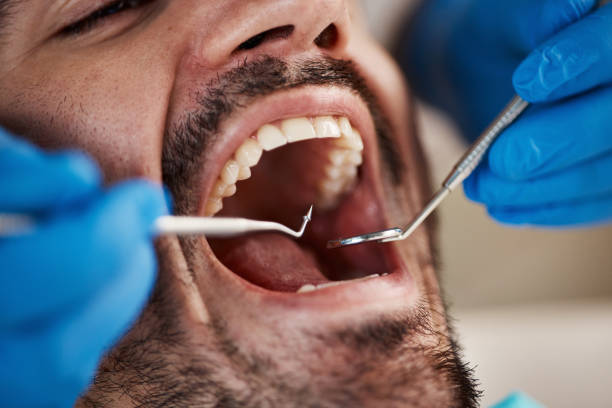 Best Emergency Dentist for Knocked-Out Tooth in Waskom, TX